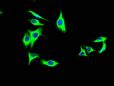 LOXL2 Recombinant Monoclonal Antibody