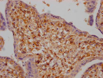 LOXL2 Recombinant Monoclonal Antibody