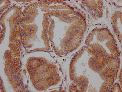 LOXL2 Recombinant Monoclonal Antibody
