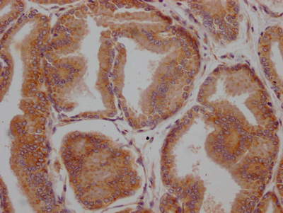 LOXL2 antibody