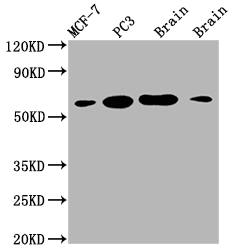 LOXL2 Recombinant Monoclonal Antibody