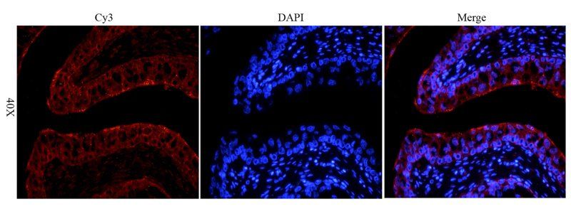 LOXL2 antibody