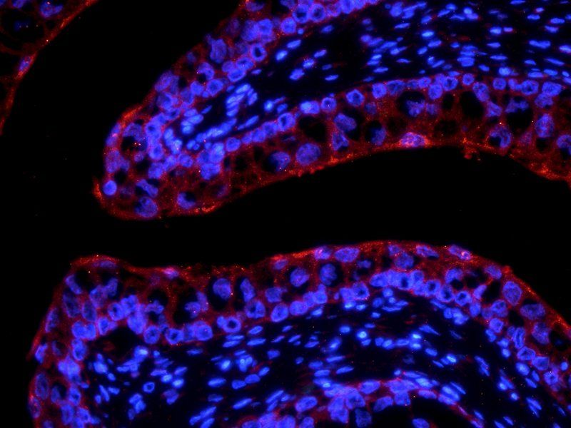 LOXL2 antibody