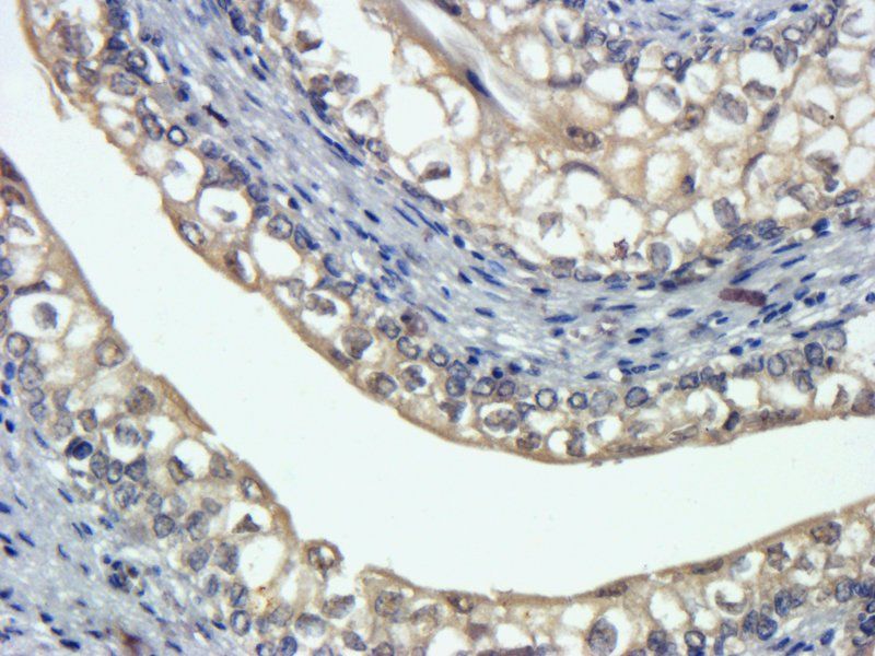 LOXL2 antibody