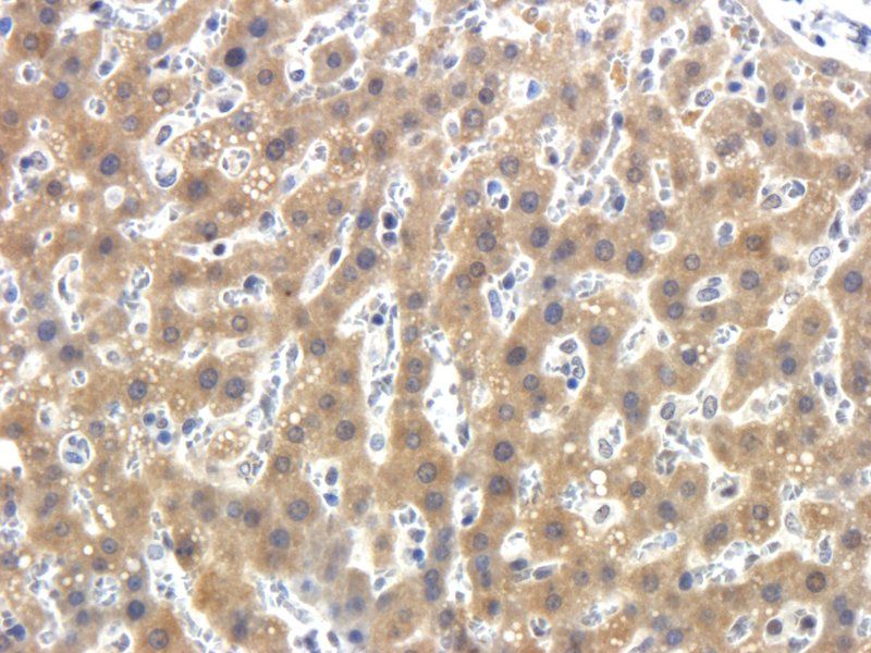 LOXL2 antibody