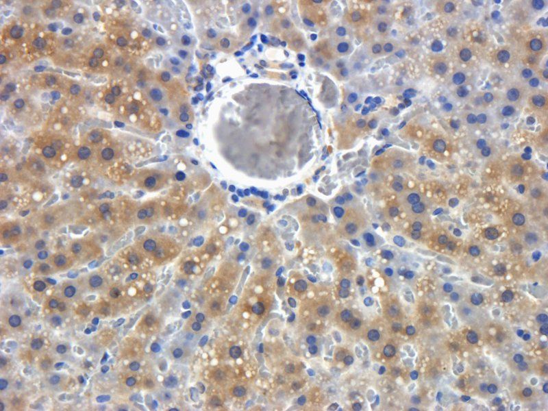 LOXL2 antibody