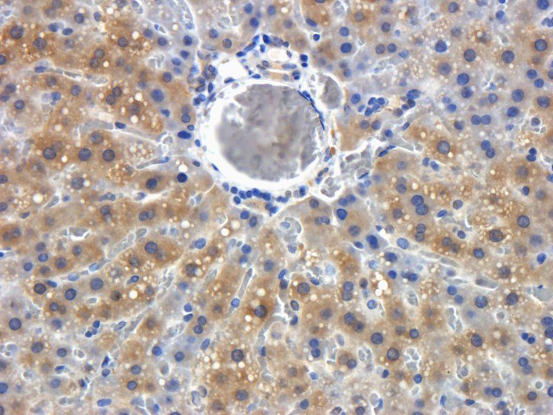 LOXL2 antibody