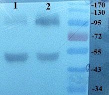 LOXL2 antibody