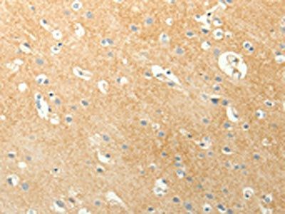 LPAR3 Antibody