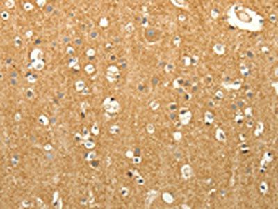 LPAR3 Antibody