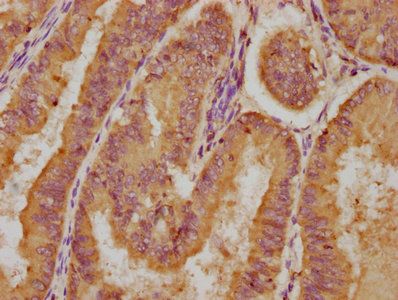 LPAR4 Antibody