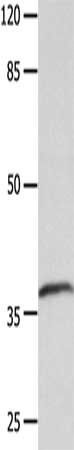 LPAR4 Antibody