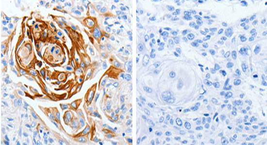 LPAR4 Antibody