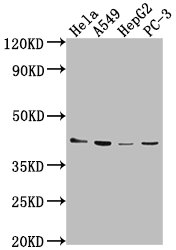 LPAR6 Antibody