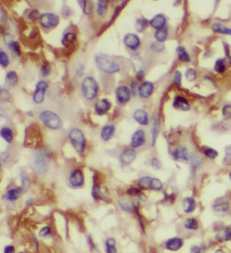 LPCAT1 antibody