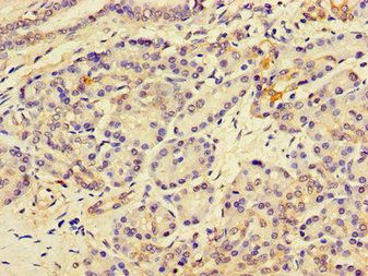 LPCAT3 Antibody