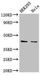 LPGAT1 Antibody