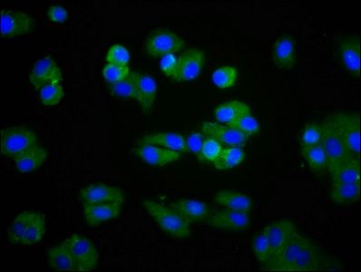 LPL antibody