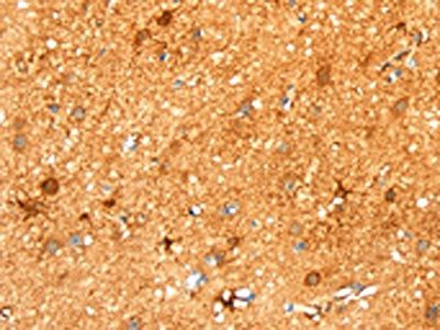 LPP Antibody
