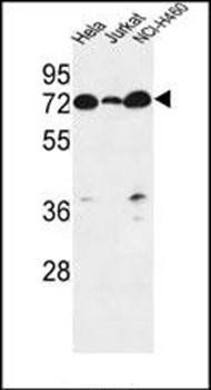 LPPR4 antibody