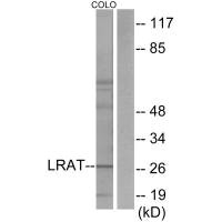 LRAT antibody