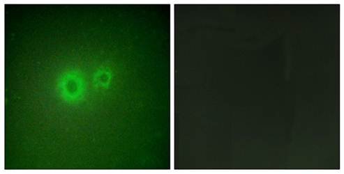 LRAT Antibody
