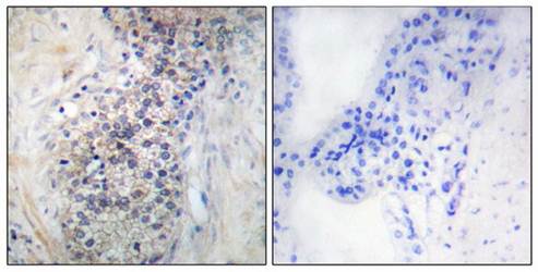 LRAT Antibody