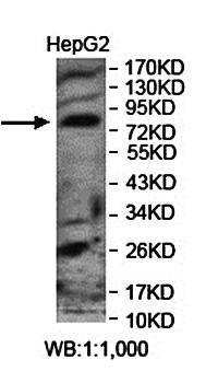 LRCH2 antibody