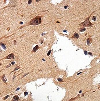 LRCH3 Rabbit Polyclonal Antibody