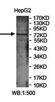 LRCH4 Rabbit Polyclonal Antibody