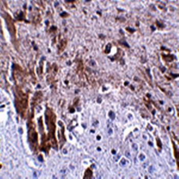 LRFN1 Antibody