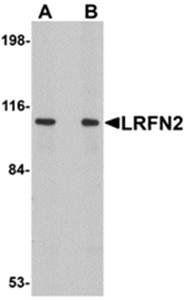 LRFN2 Antibody