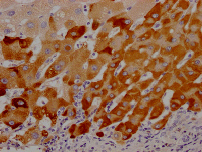 LRG1 Recombinant Monoclonal Antibody