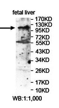 LRIG2 antibody