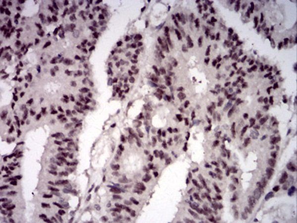 LRP1 Antibody