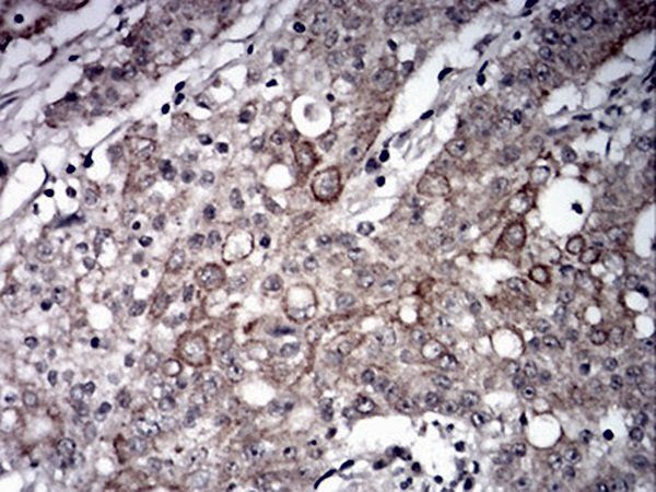 LRP1 Antibody