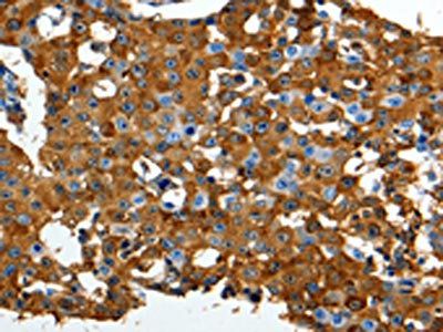 LRP1 Antibody
