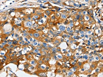 LRP1 Antibody