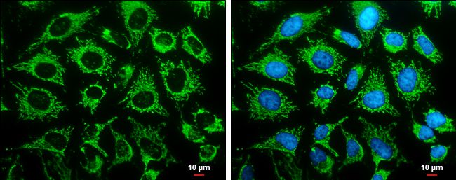 LRP130 Rabbit Polyclonal Antibody