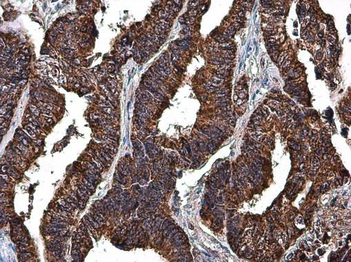 LRP130 Rabbit Polyclonal Antibody