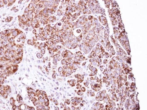 LRP130 Rabbit Polyclonal Antibody