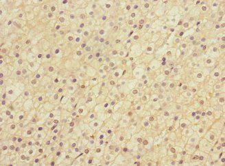 LRP4 Antibody
