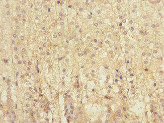 LRP4 Antibody