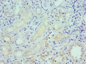 LRP6 Antibody