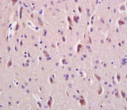 LRP6 Rabbit Polyclonal Antibody