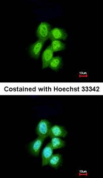 LRP(MVP) Rabbit Polyclonal Antibody