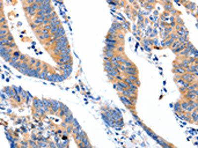 LRPAP1 antibody