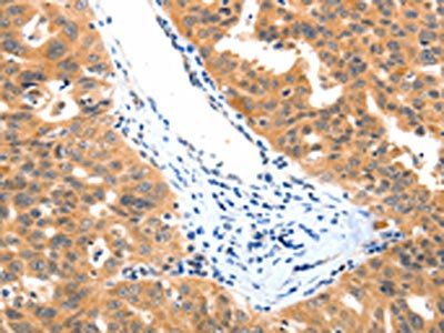 LRPPRC Antibody