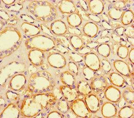 LRR1 Antibody