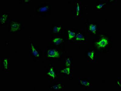 LRRC15 antibody